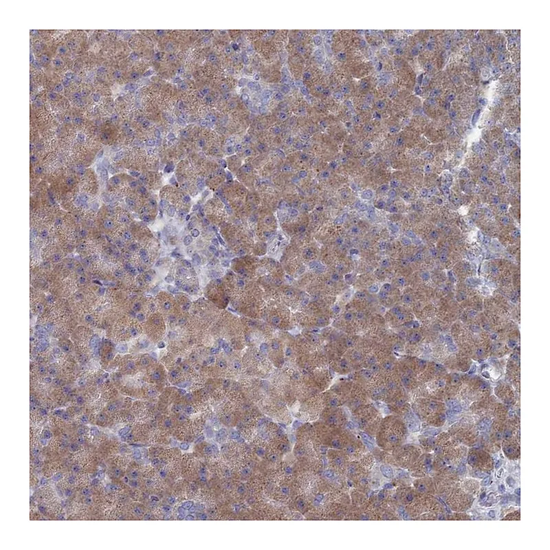 Atlas Antibodies Anti-TMEM128 Antibody