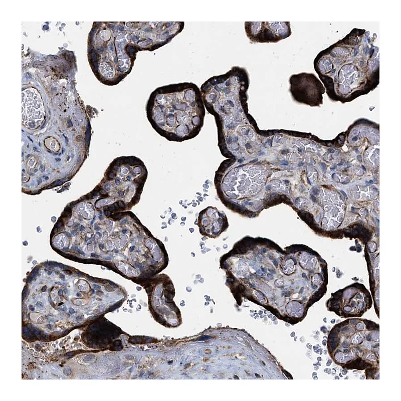 Atlas Antibodies Anti-TMEM131 Antibody