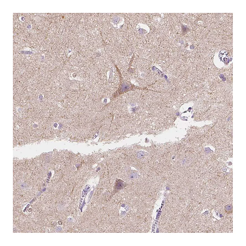 Atlas Antibodies Anti-TMEM130 Antibody