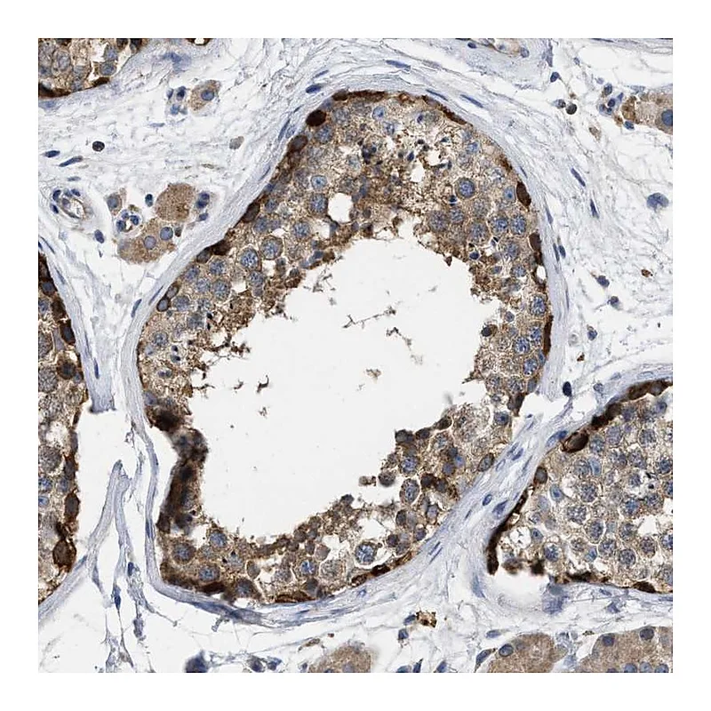 Atlas Antibodies Anti-TMEM131 Antibody