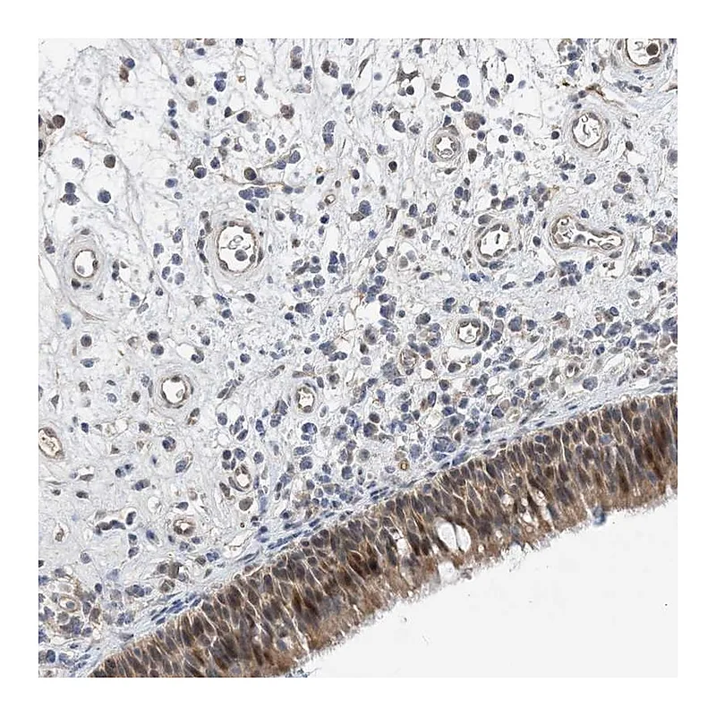 Atlas Antibodies Anti-TMEM132B Antibody