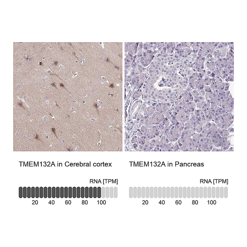 Atlas Antibodies Anti-TMEM132A Antibody