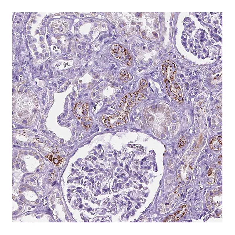 Atlas Antibodies Anti-TMEM132E Antibody