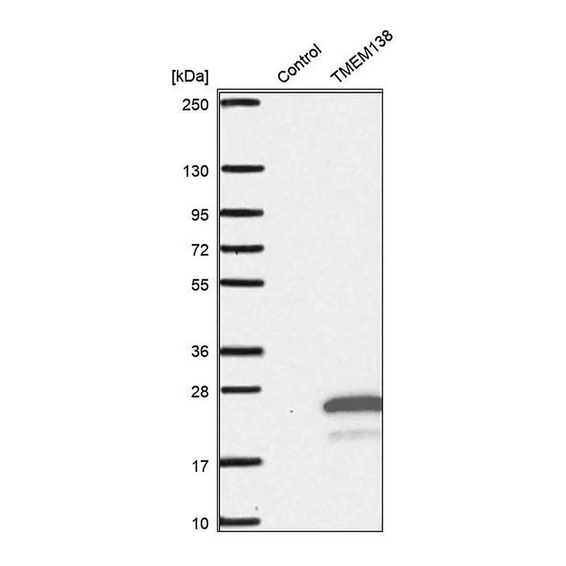 Atlas Antibodies Anti-TMEM138 Antibody