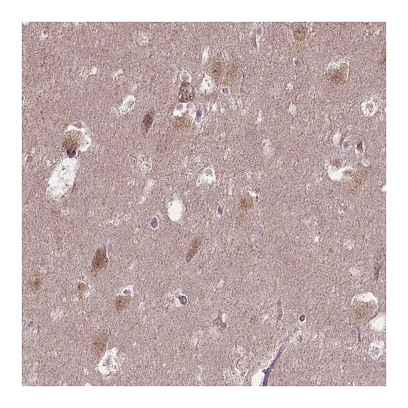 Atlas Antibodies Anti-TMEM135 Antibody