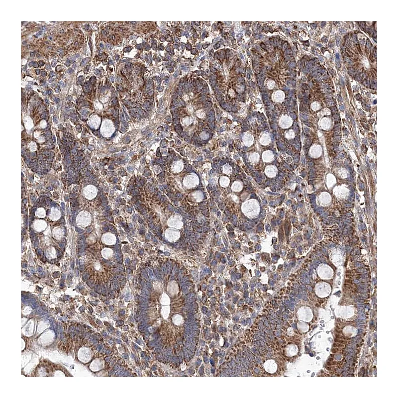 Atlas Antibodies Anti-TMEM139 Antibody