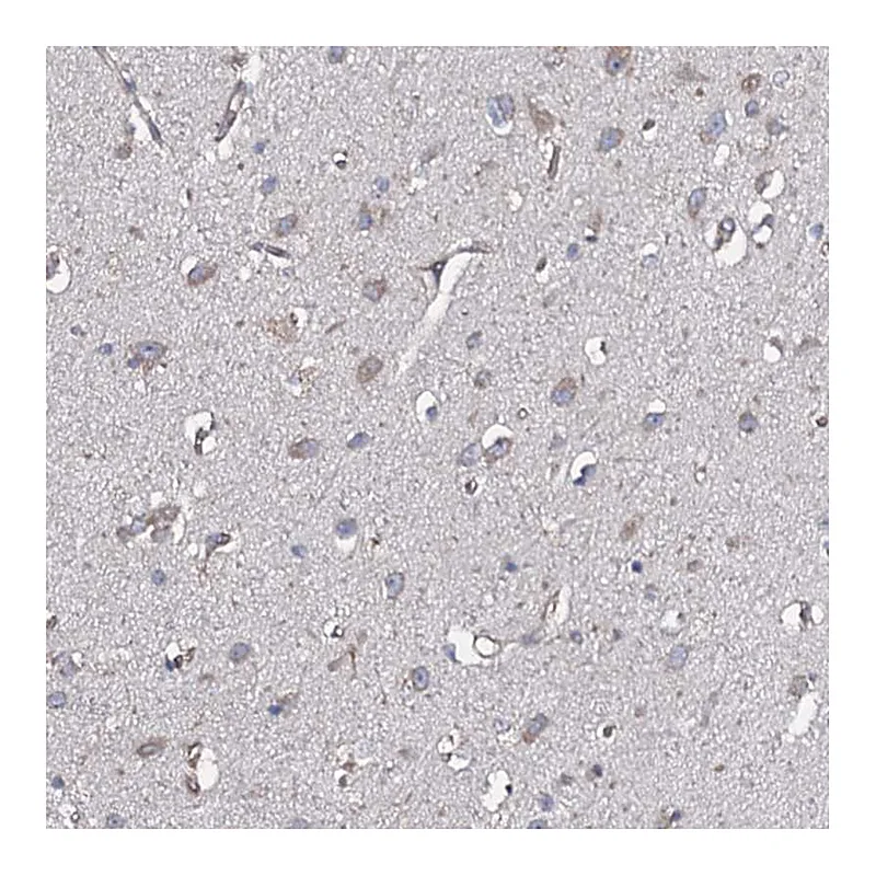 Atlas Antibodies Anti-TMEM151A Antibody