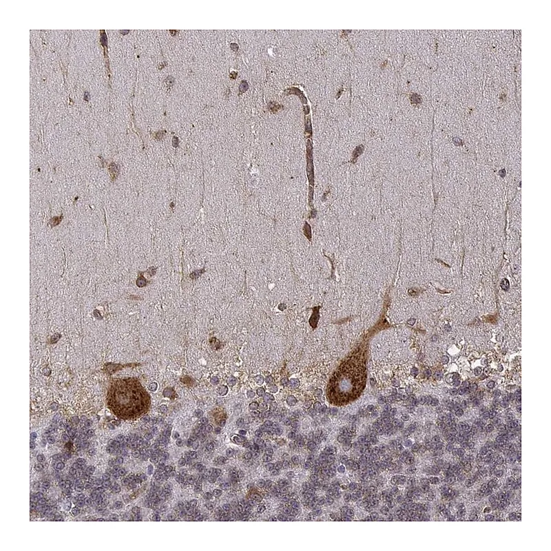 Atlas Antibodies Anti-TMEM14A Antibody