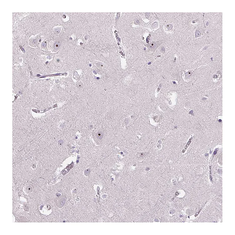 Atlas Antibodies Anti-TMEM151B Antibody