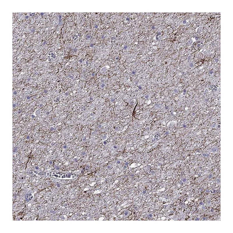 Atlas Antibodies Anti-TMEM155 Antibody