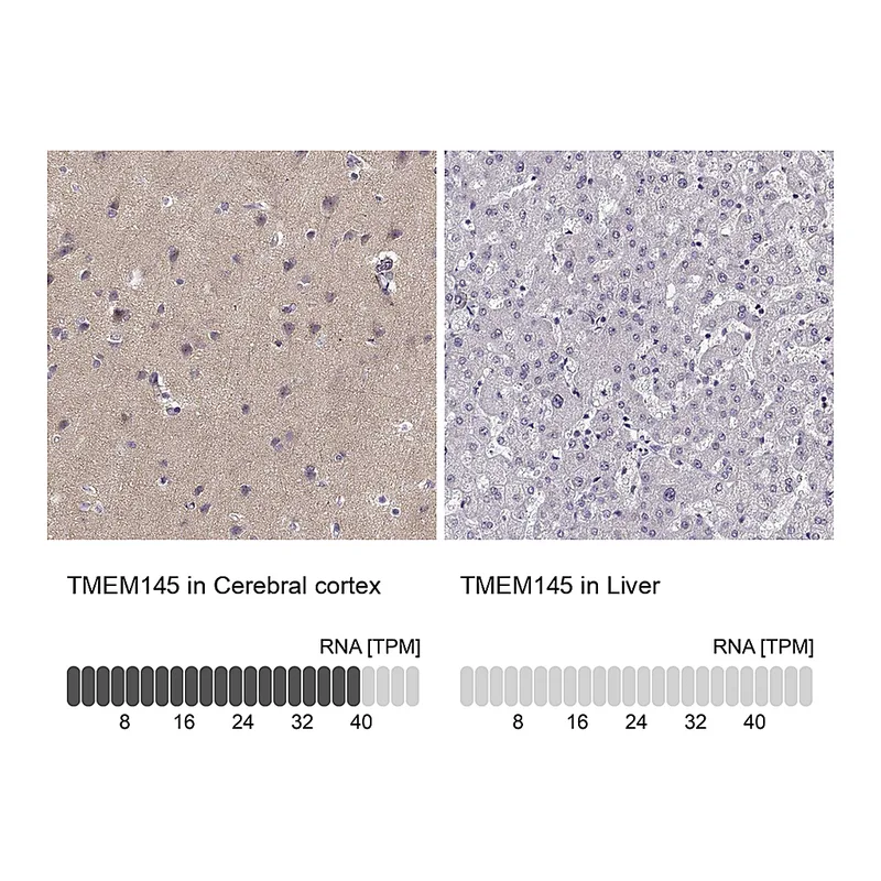Atlas Antibodies Anti-TMEM145 Antibody