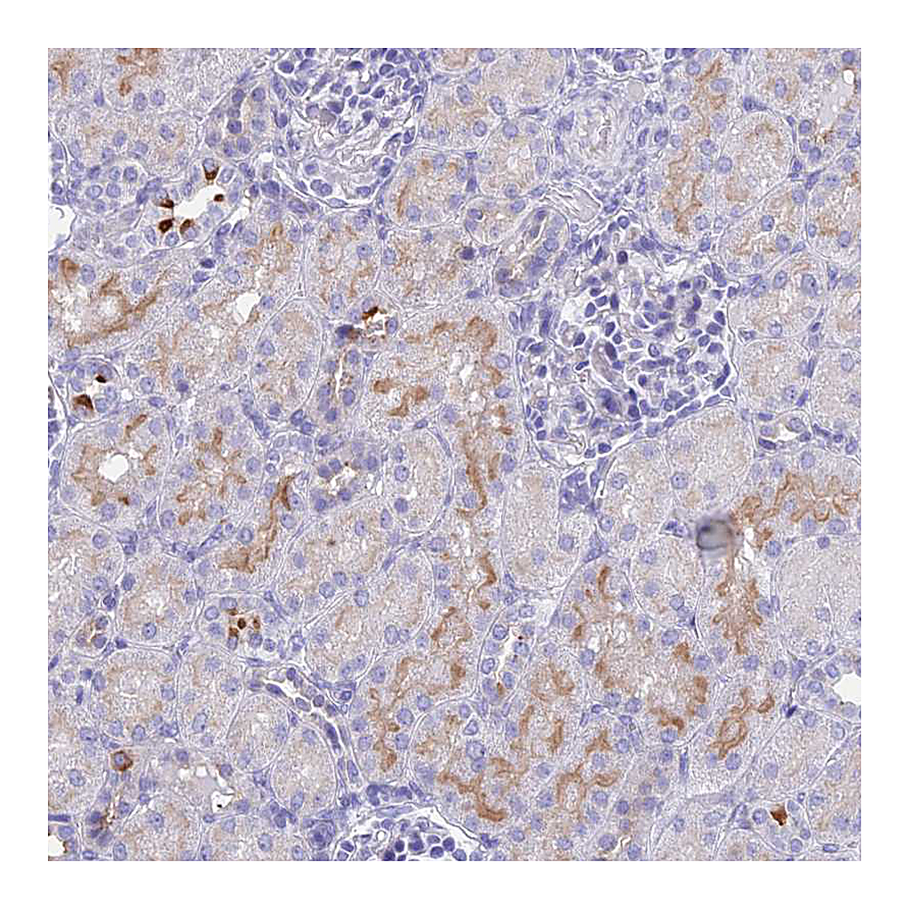 Atlas Antibodies Anti-TMEM161B Antibody