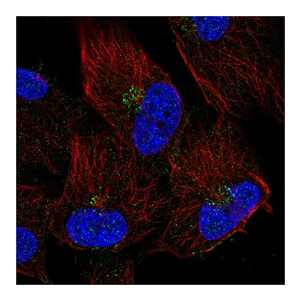 Atlas Antibodies Anti-TMEM165 Antibody