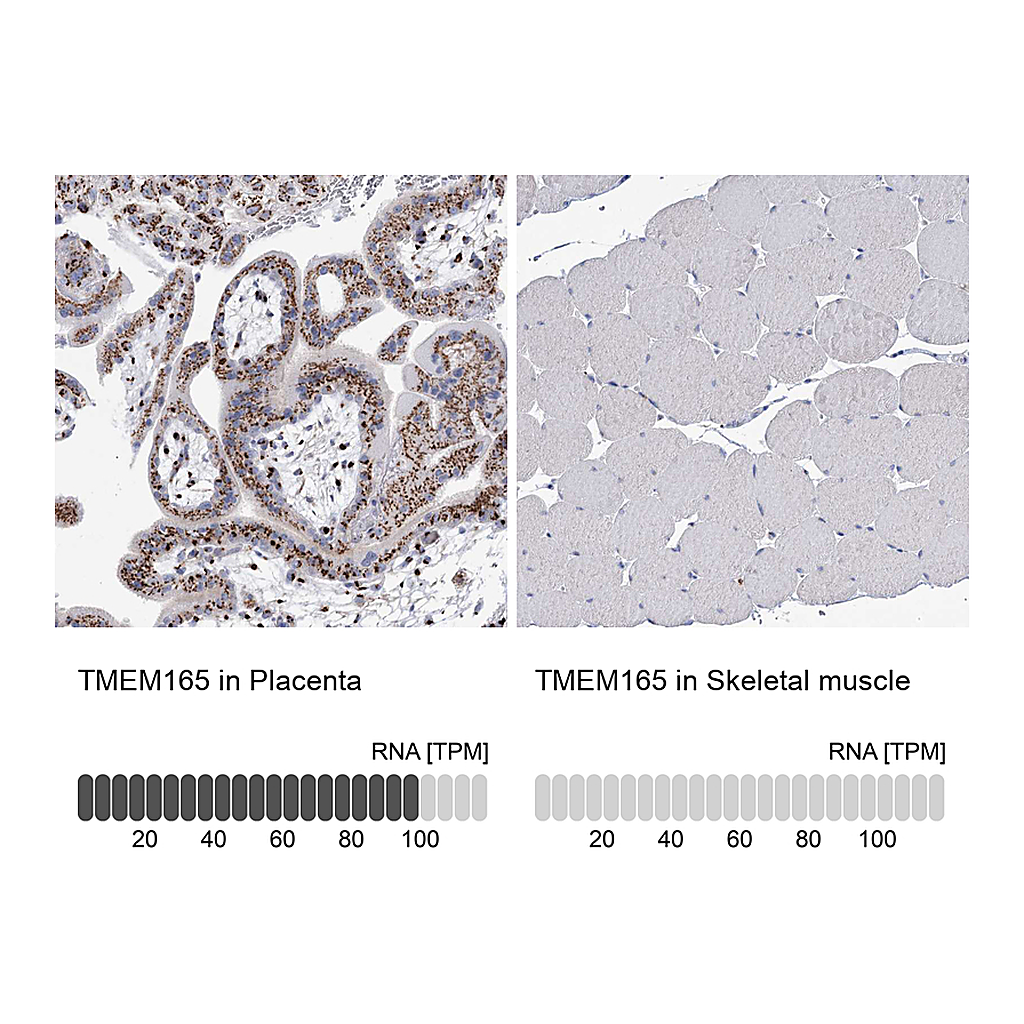 Atlas Antibodies Anti-TMEM165 Antibody
