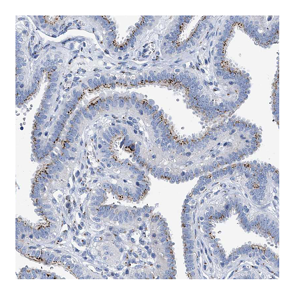 Atlas Antibodies Anti-TMEM17 Antibody