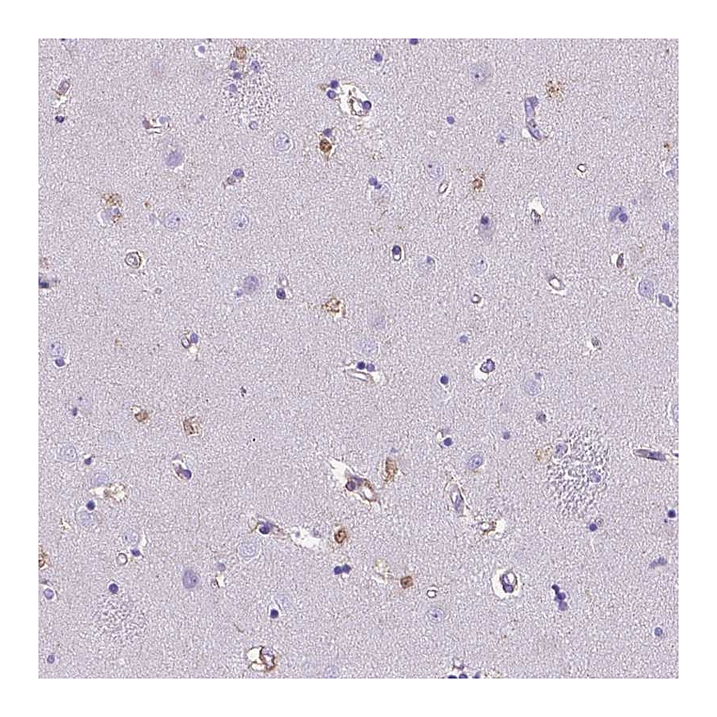Atlas Antibodies Anti-TMEM169 Antibody