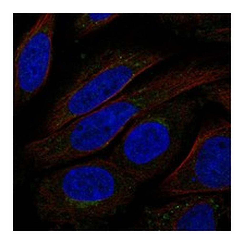 Atlas Antibodies Anti-TMEM168 Antibody
