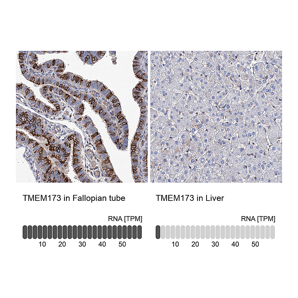 Atlas Antibodies Anti-TMEM173 Antibody