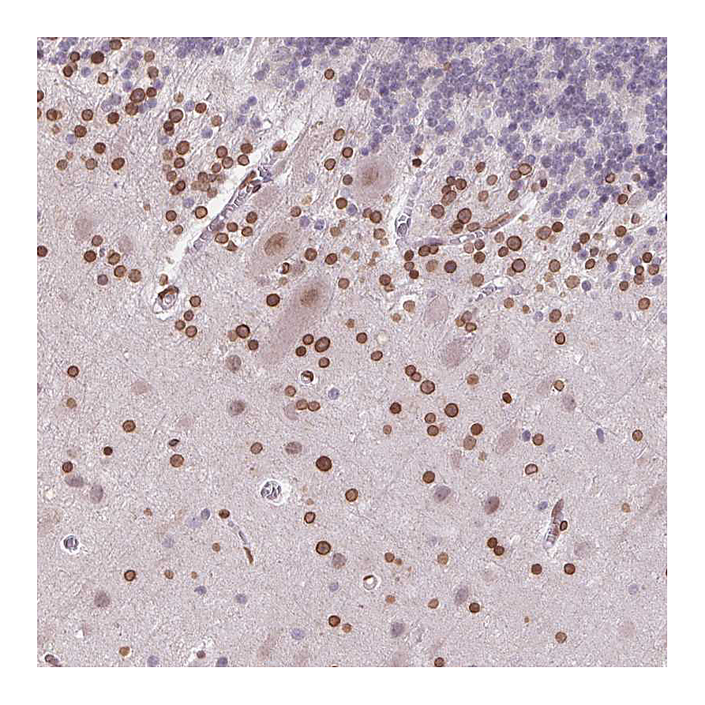 Atlas Antibodies Anti-TMEM175 Antibody
