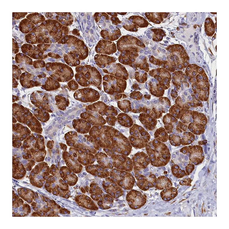Atlas Antibodies Anti-TMEM18 Antibody