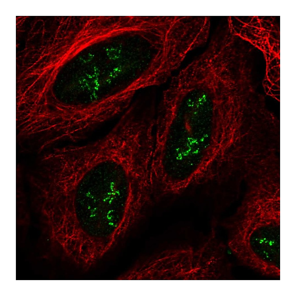 Atlas Antibodies Anti-TMEM177 Antibody