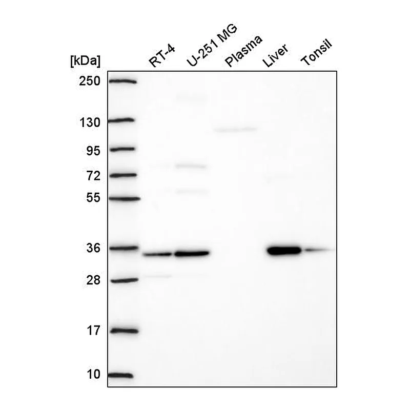 Atlas Antibodies Anti-TMEM183A Antibody