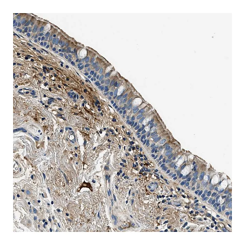 Atlas Antibodies Anti-TMEM186 Antibody