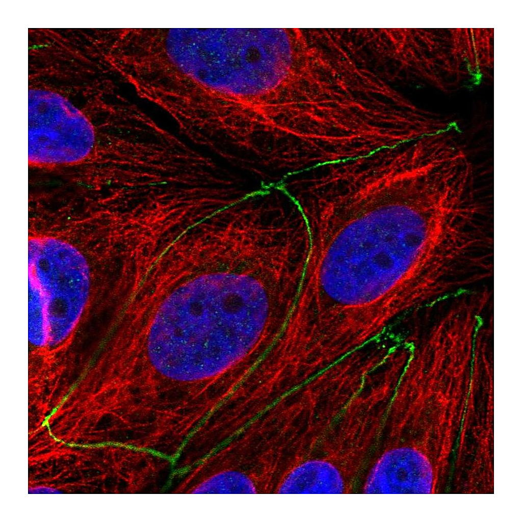 Atlas Antibodies Anti-TMEM186 Antibody