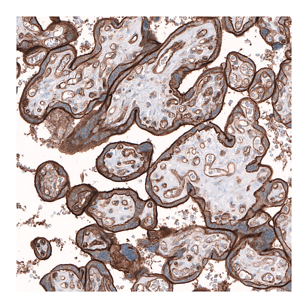 Atlas Antibodies Anti-TMEM2 Antibody