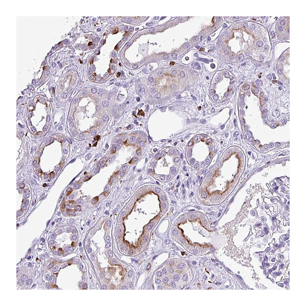 Atlas Antibodies Anti-TMEM200C Antibody