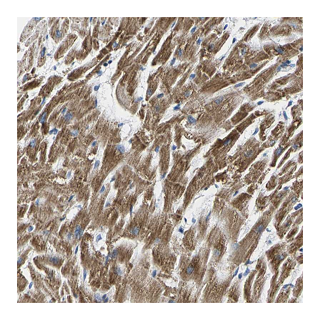 Atlas Antibodies Anti-TMEM204 Antibody