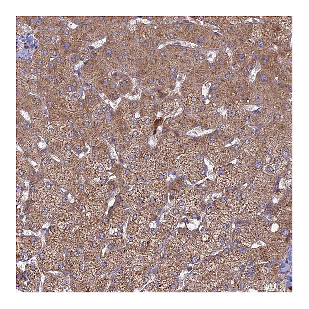 Atlas Antibodies Anti-TMEM208 Antibody