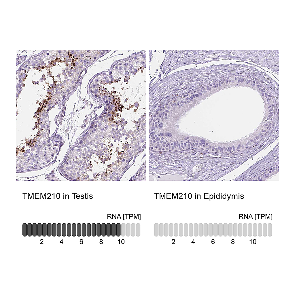 Atlas Antibodies Anti-TMEM210 Antibody