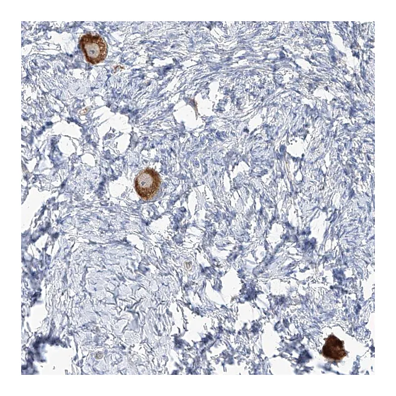 Atlas Antibodies Anti-TMEM209 Antibody