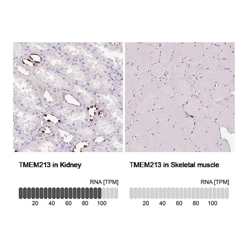 Atlas Antibodies Anti-TMEM213 Antibody