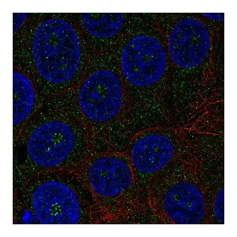 Atlas Antibodies Anti-TMEM217 Antibody
