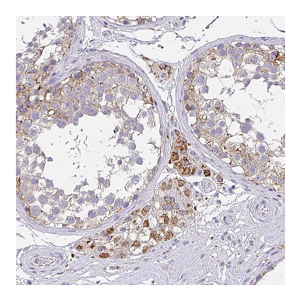 Atlas Antibodies Anti-TMEM219 Antibody