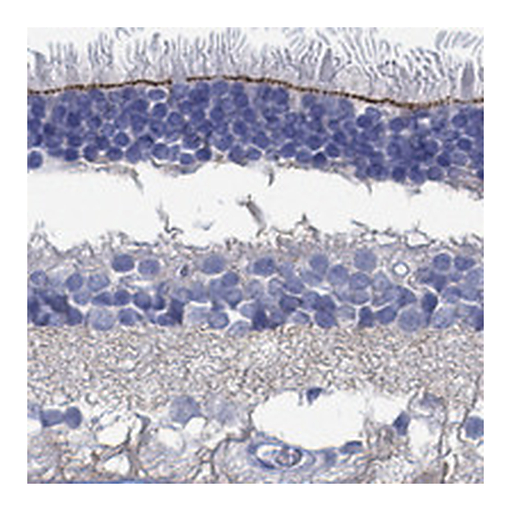 Atlas Antibodies Anti-TMEM221 Antibody