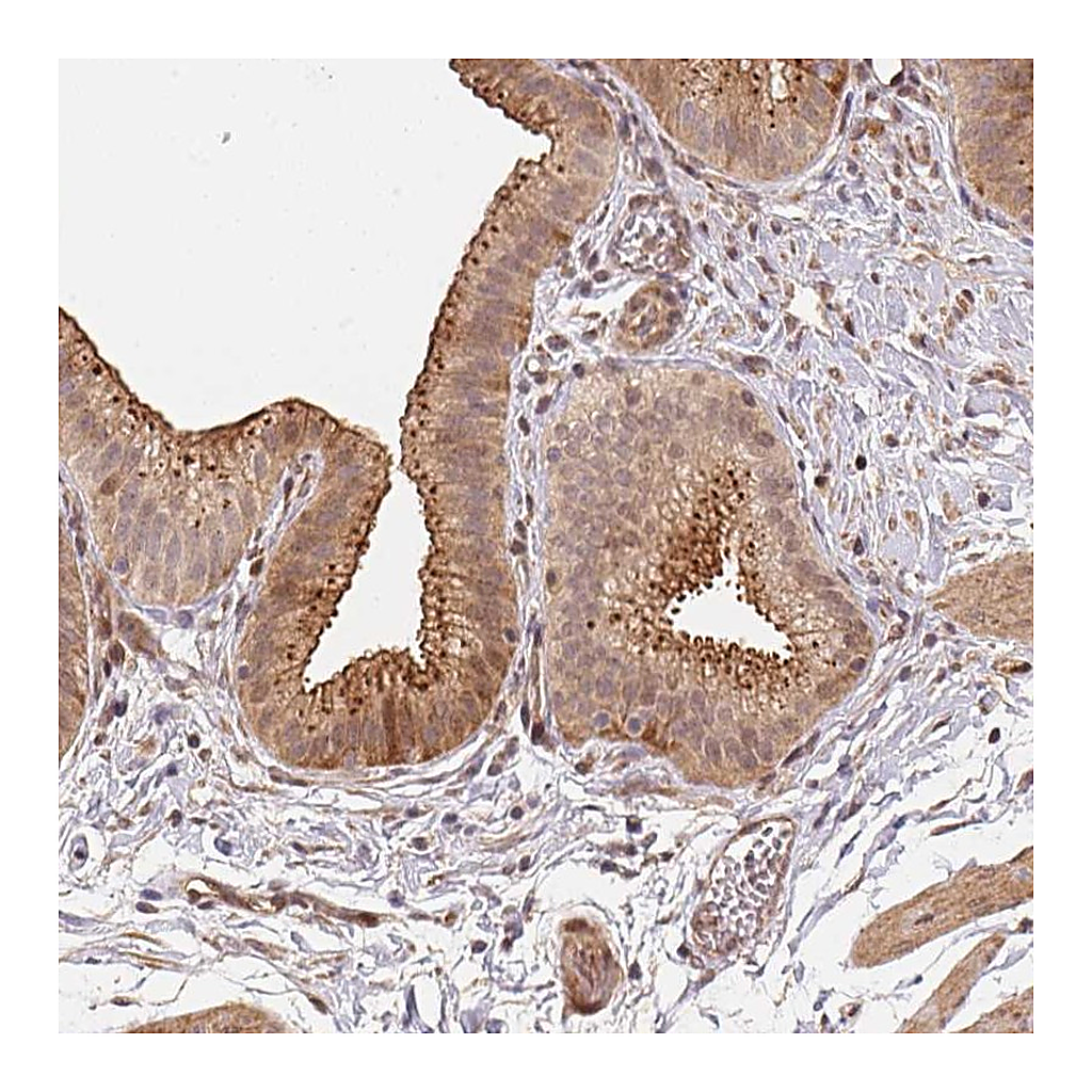 Atlas Antibodies Anti-TMEM222 Antibody