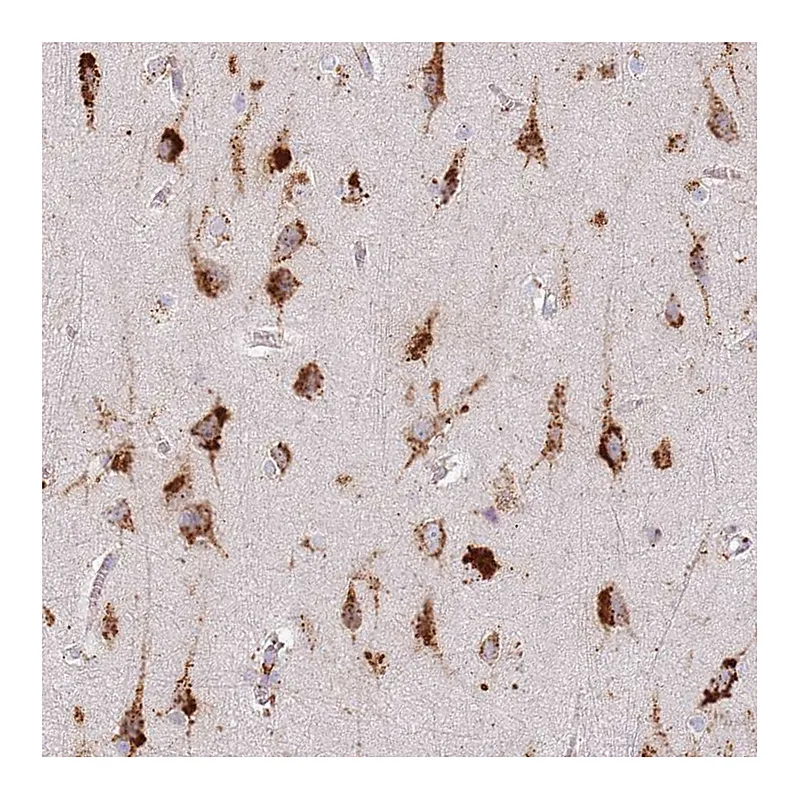 Atlas Antibodies Anti-TMEM229B Antibody