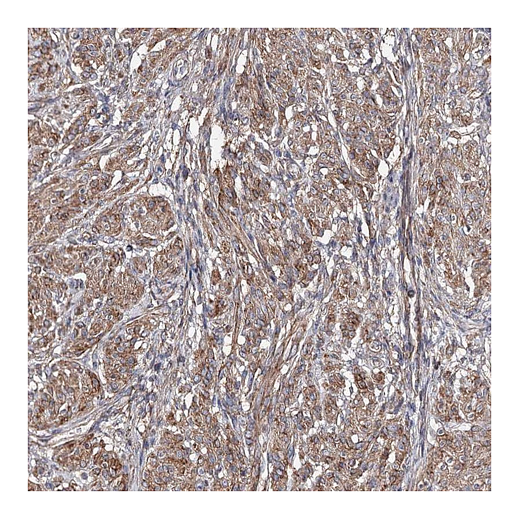 Atlas Antibodies Anti-TMEM218 Antibody