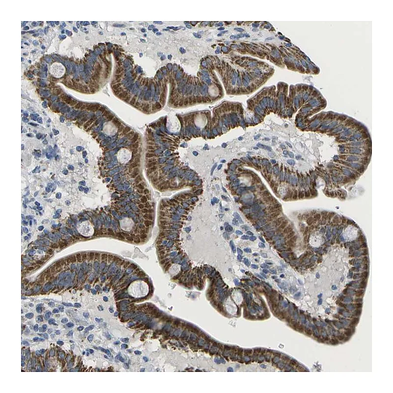 Atlas Antibodies Anti-TMEM223 Antibody