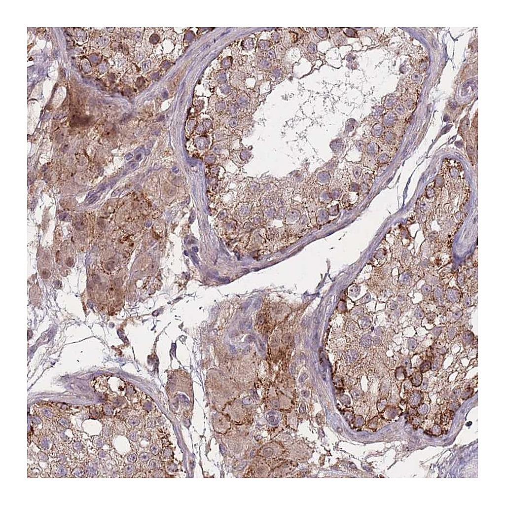 Atlas Antibodies Anti-TMEM232 Antibody