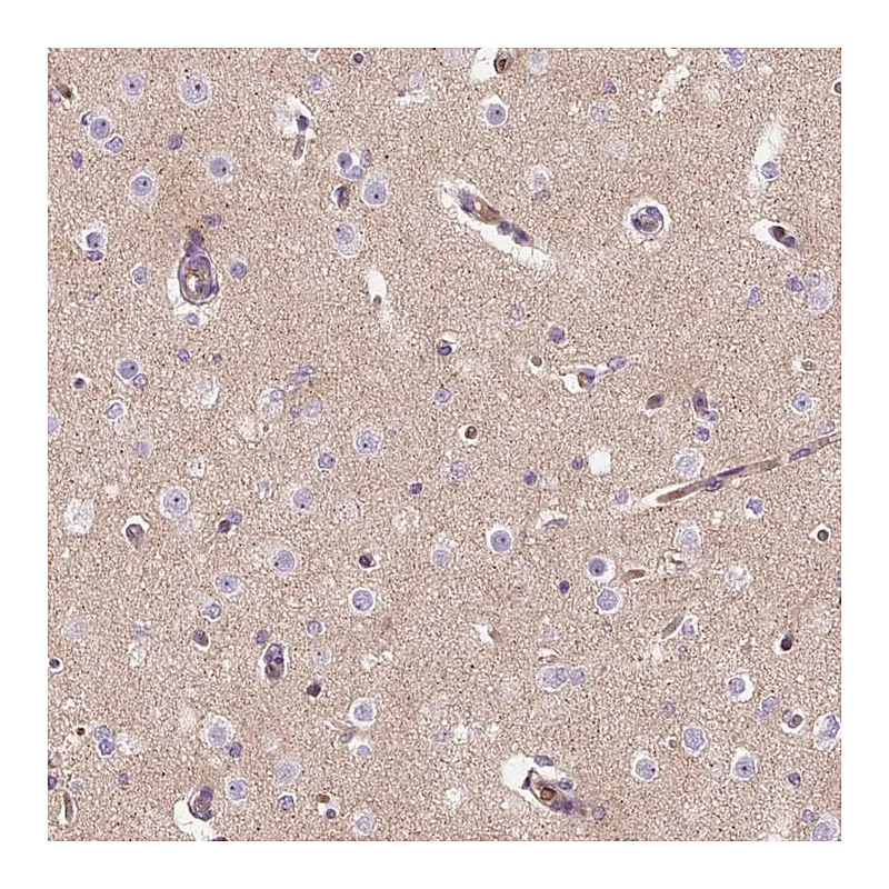Atlas Antibodies Anti-TMEM235 Antibody