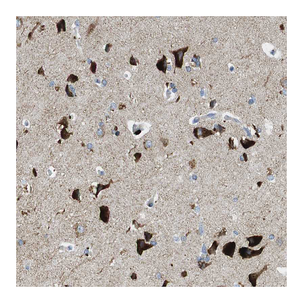 Atlas Antibodies Anti-TMEM234 Antibody