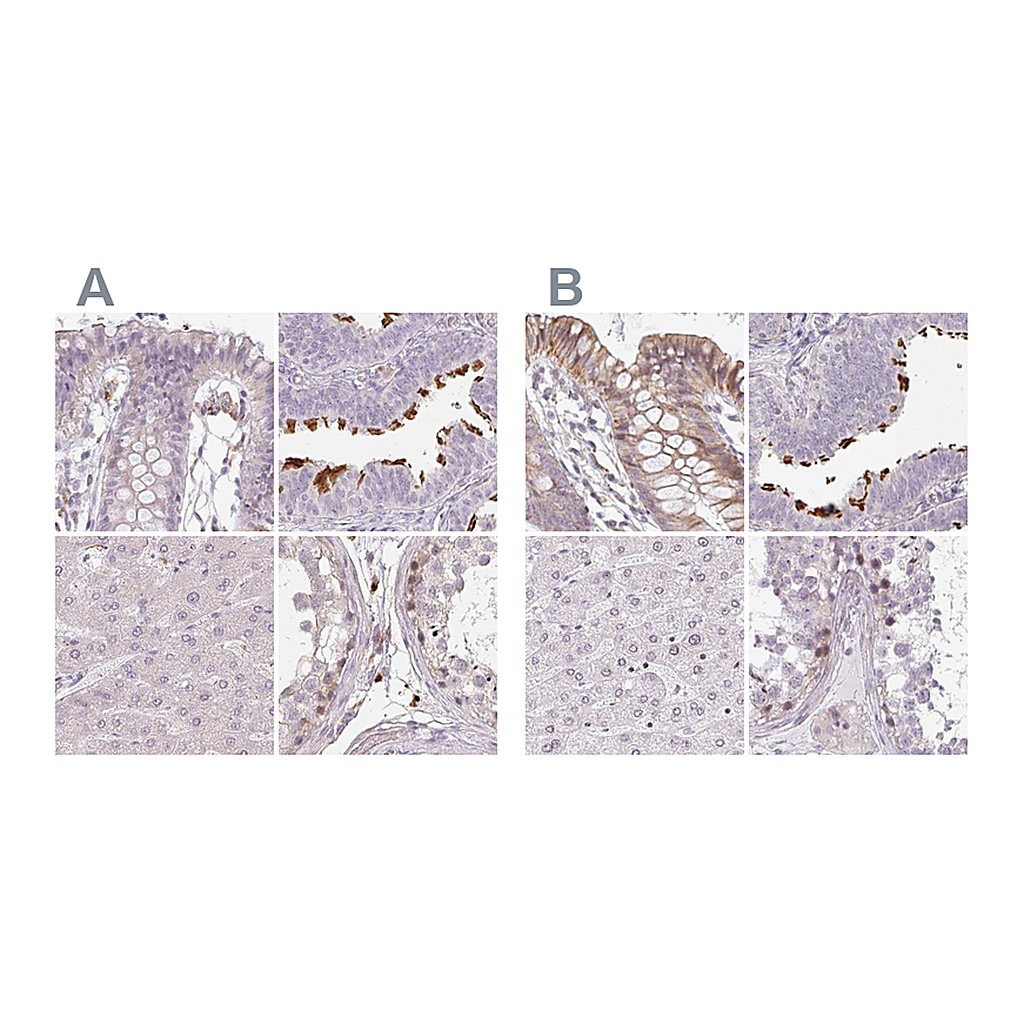 Atlas Antibodies Anti-TMEM237 Antibody