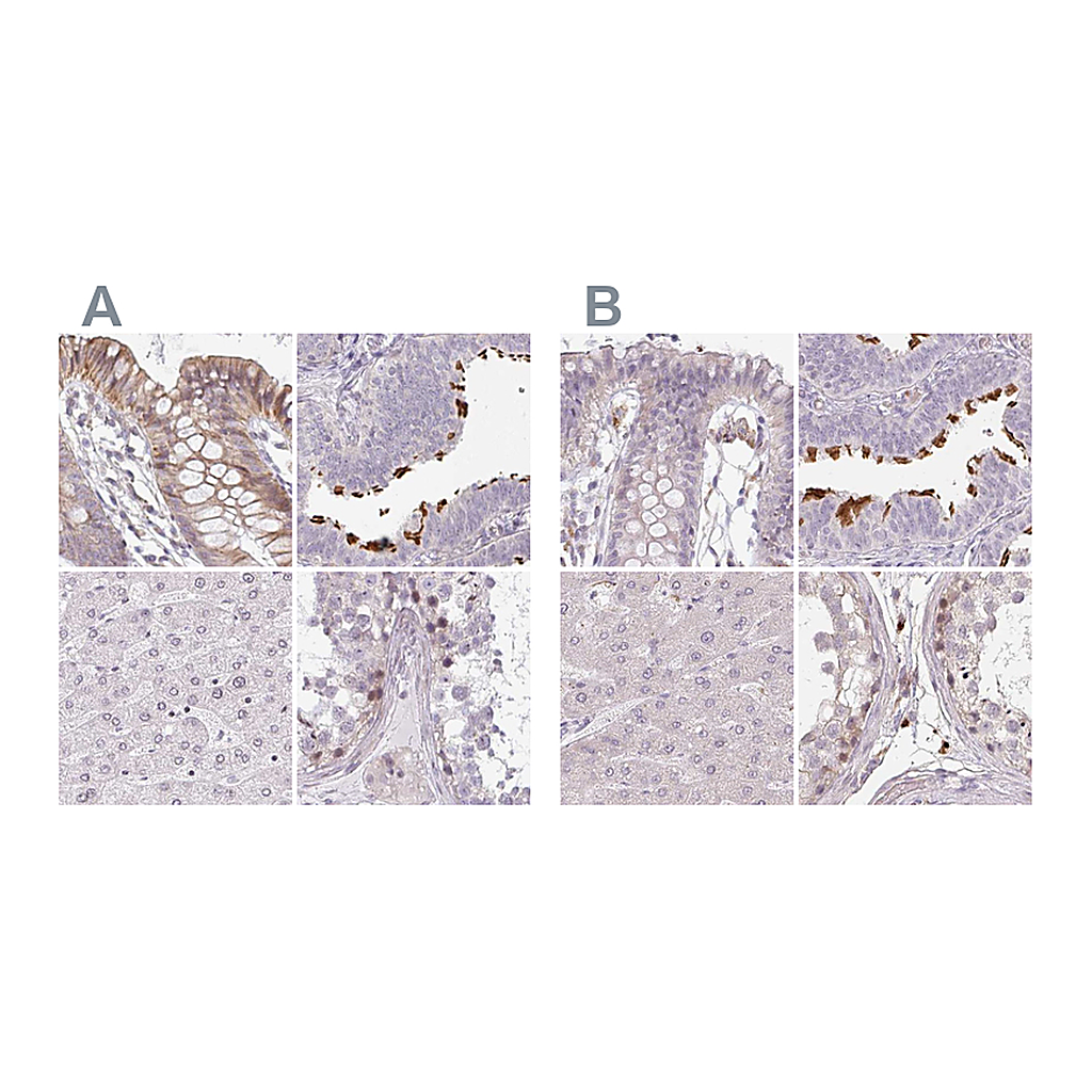 Atlas Antibodies Anti-TMEM237 Antibody