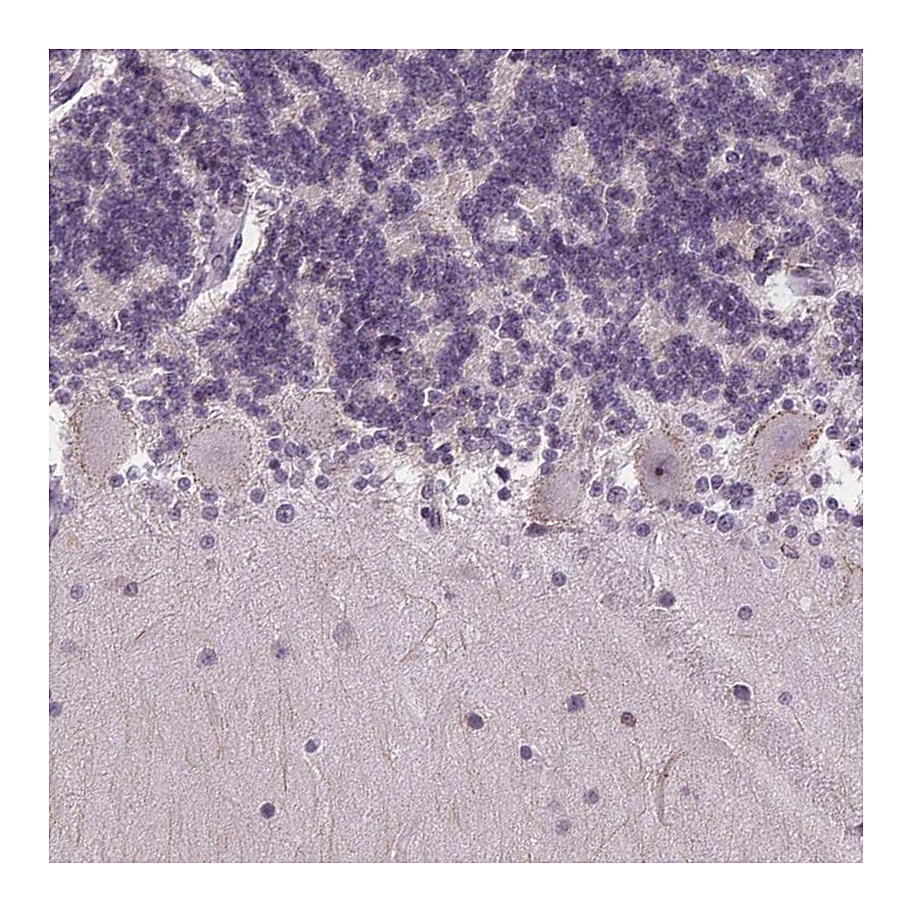 Atlas Antibodies Anti-TMEM240 Antibody
