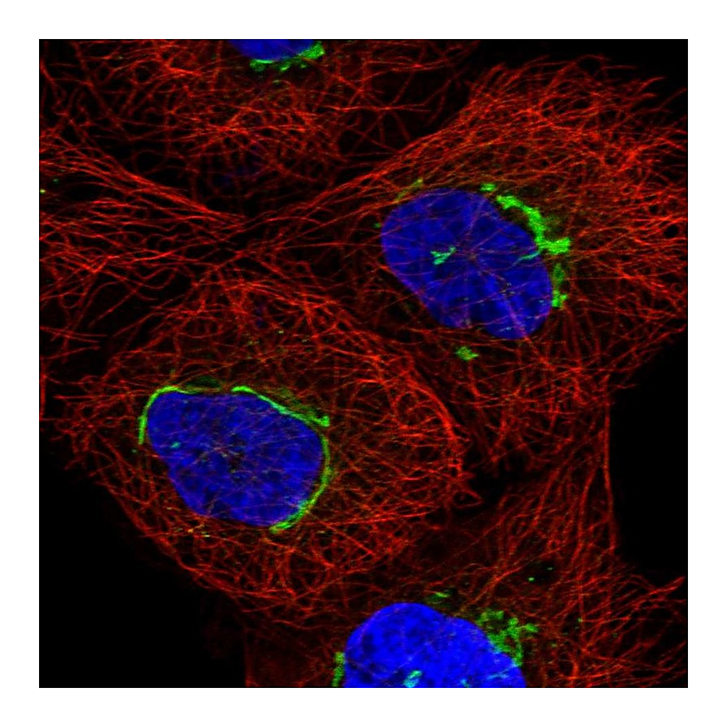 Atlas Antibodies Anti-TMEM25 Antibody