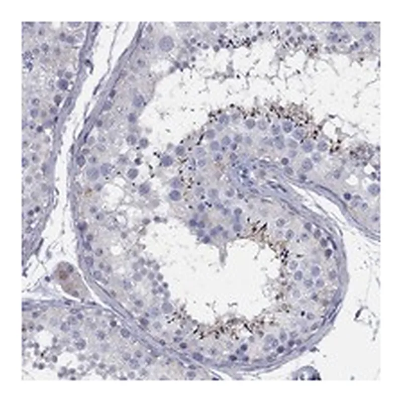 Atlas Antibodies Anti-TMEM249 Antibody